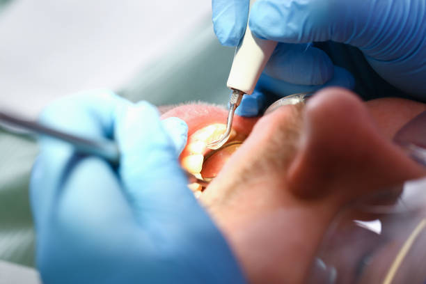 Best Weekend Emergency Dentist in South San Gabriel, CA