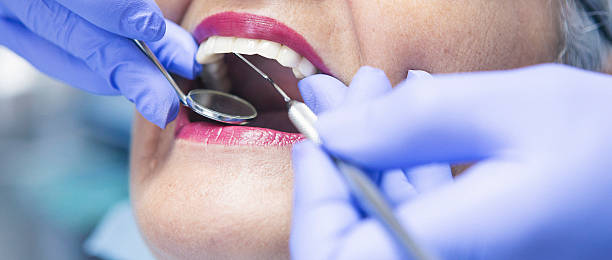 Best Urgent Care for Lost Fillings or Crowns in South San Gabriel, CA